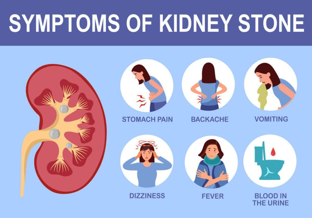 Sunrise Hospital. Patient-133, symptoms of kidney stones