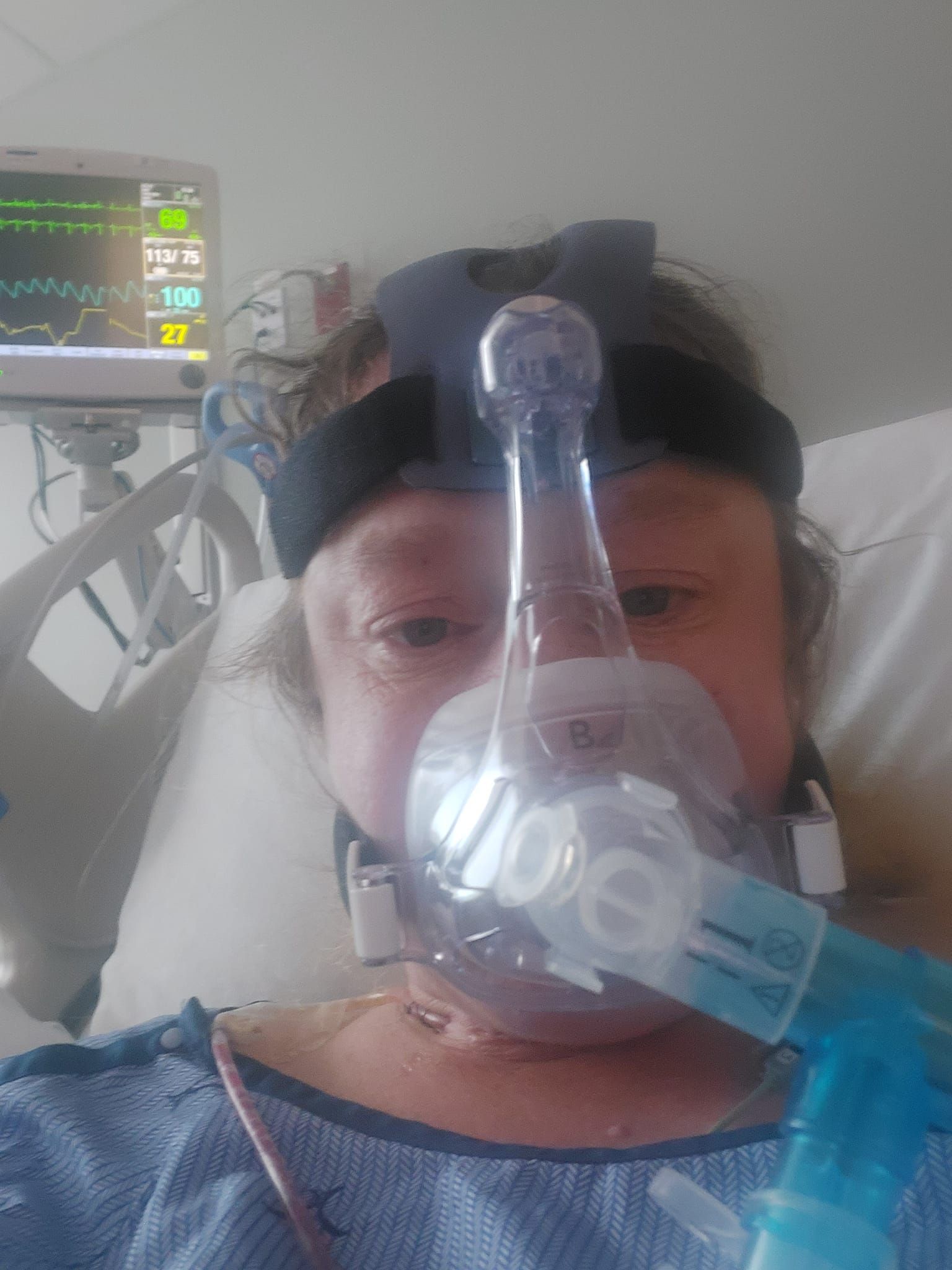 Patient-66 posted this photo, read her story