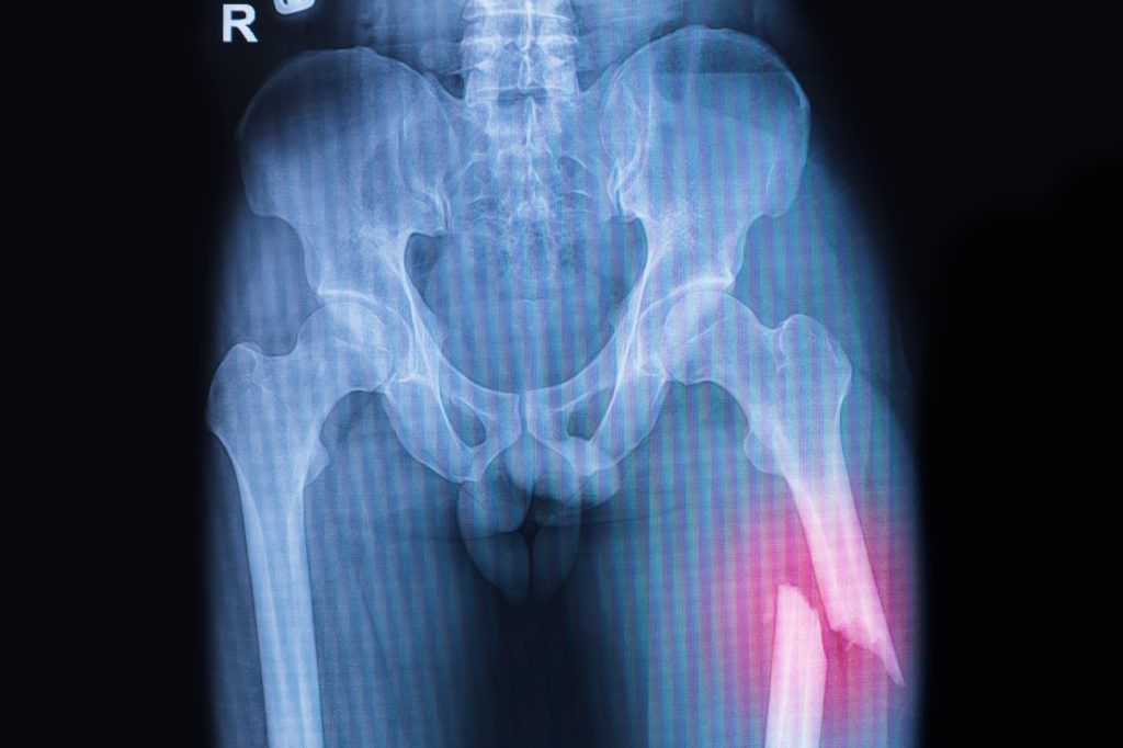 Another case of Nevada Orthopedic refusing to approval a referral