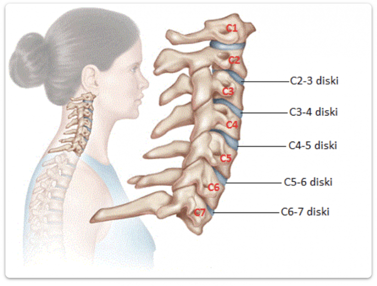 Dr Reynold Rimoldi was rude and dismissive and ignored a patient's pain which was due to two herniated discs