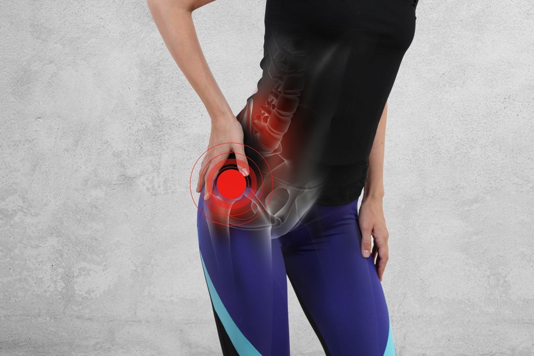 Stock-photo-illustrating-pain-due-to-botched-hip-replacement Stock photo illustrating pain due to botched hip replacement