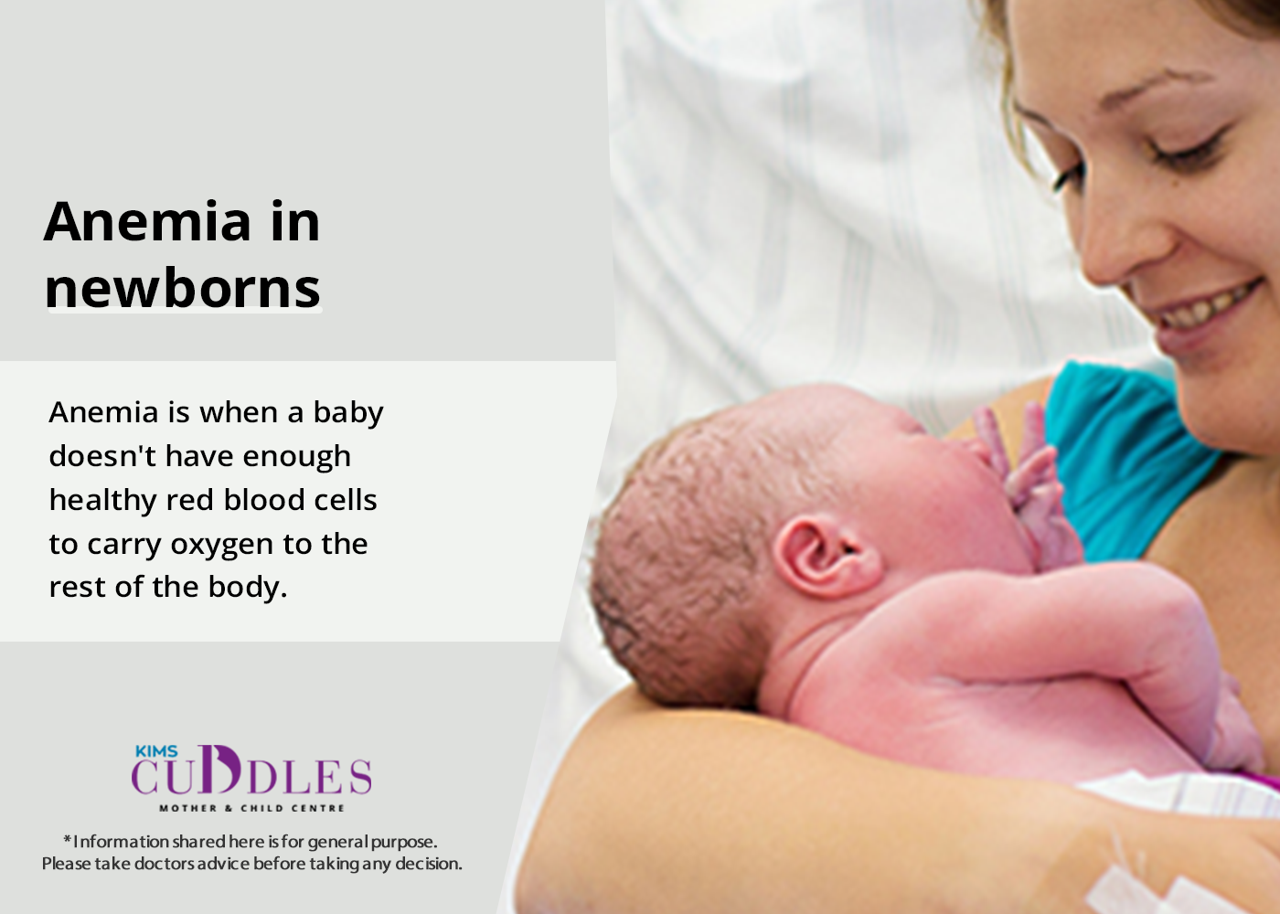 Sunrise Hospital. Patient-10, stock photo of newborn baby with anemia