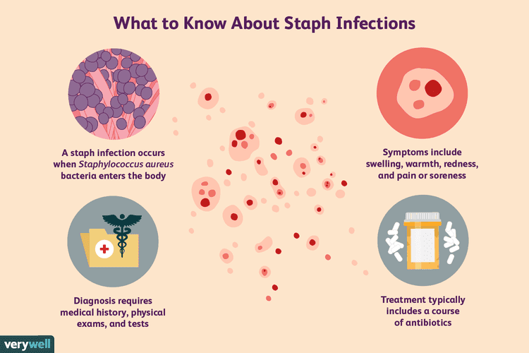 Sunrise Hospital, no treatment, no diagnosis, patient later went to ENT who found staph infection
