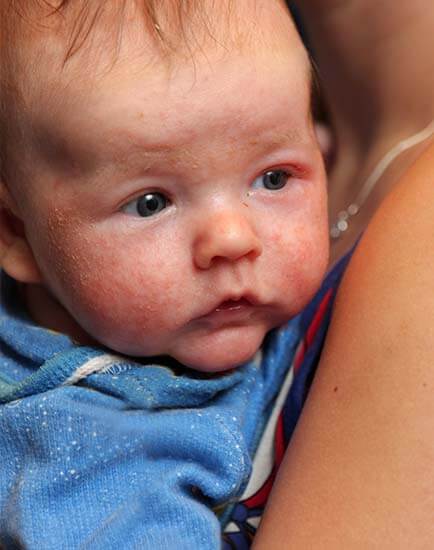 Dra. Ondina Marlene Garibay Vargas