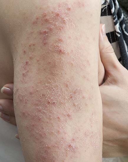 Dra. Ondina Marlene Garibay Vargas