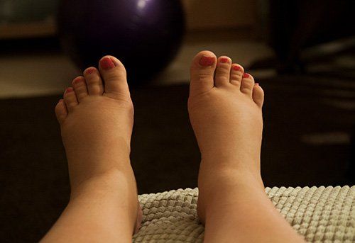 Feet with Neuroma — Pensacola, FL — Pensacola Podiatry P.A.
