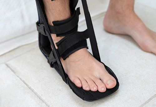 Foot in A Leg Splint — Pensacola, FL — Pensacola Podiatry P.A.