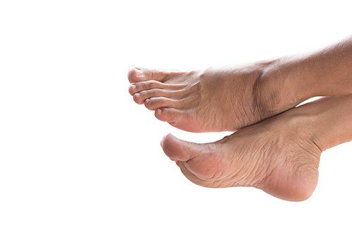 Adult's Feet — Pensacola, FL — Pensacola Podiatry P.A.