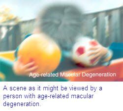 vision with macular degeneration