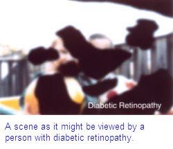 vision with diabetic retinopathy