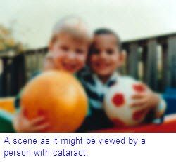 vision with Cataract