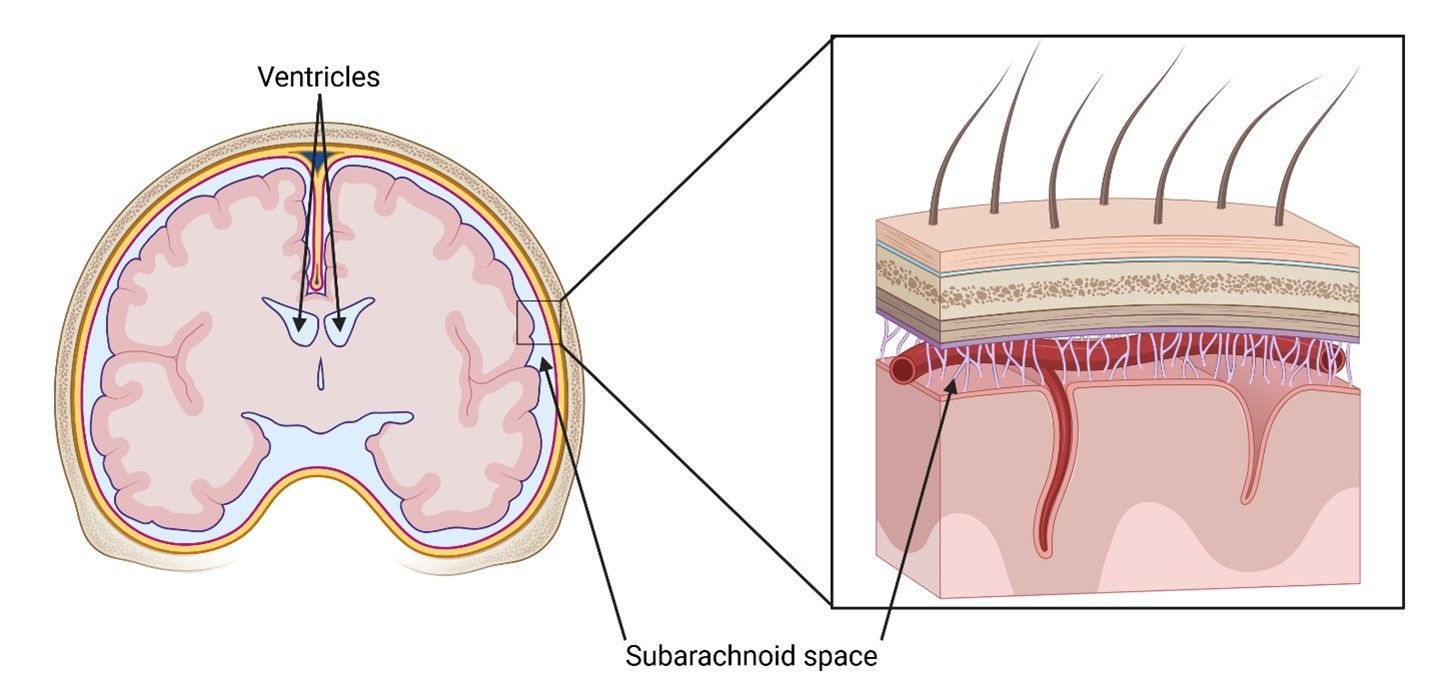 Cross-section of the head showing the brain, ventricles, and scalp with a zoomed-in section.