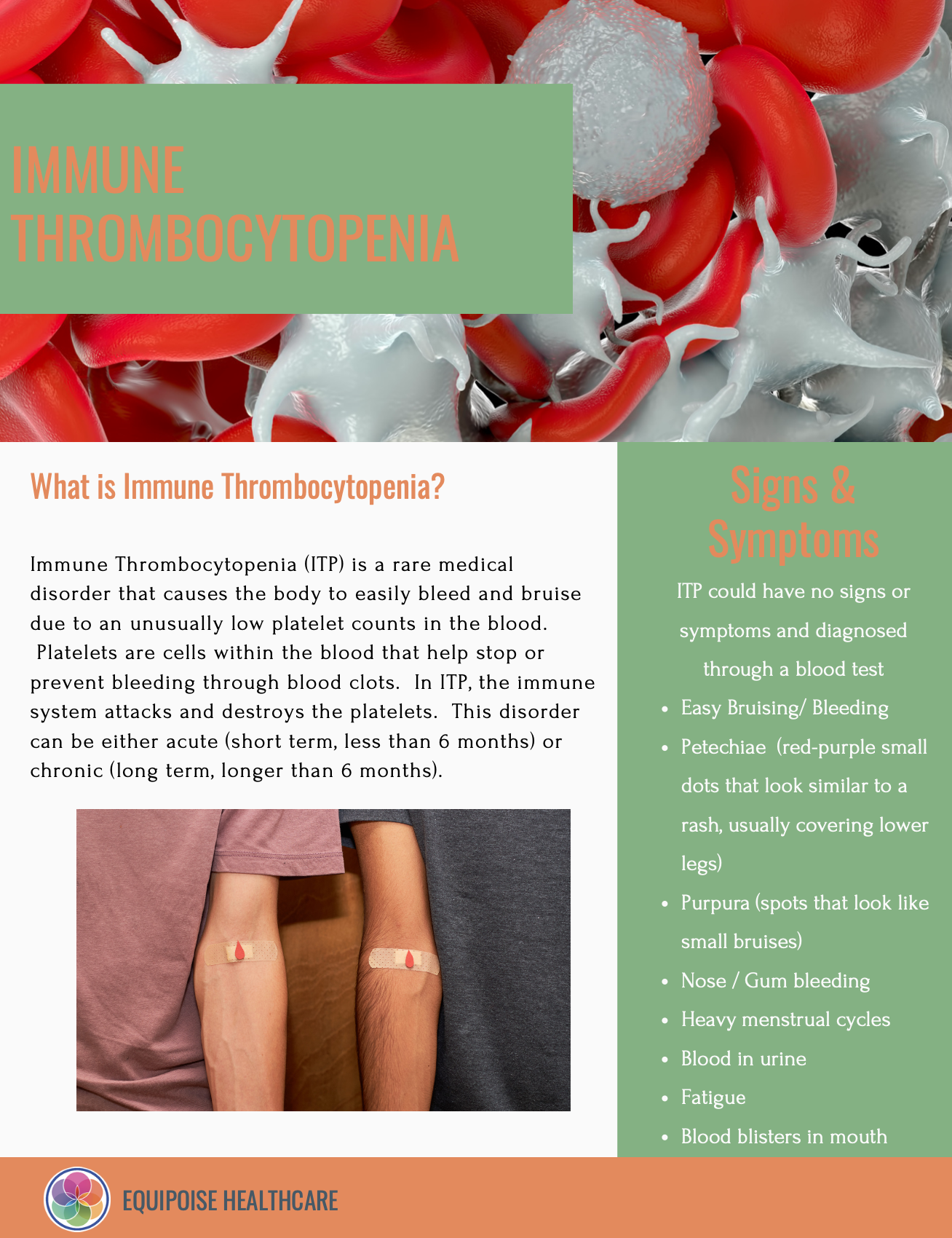 Immune Thrombocytopenia brochure