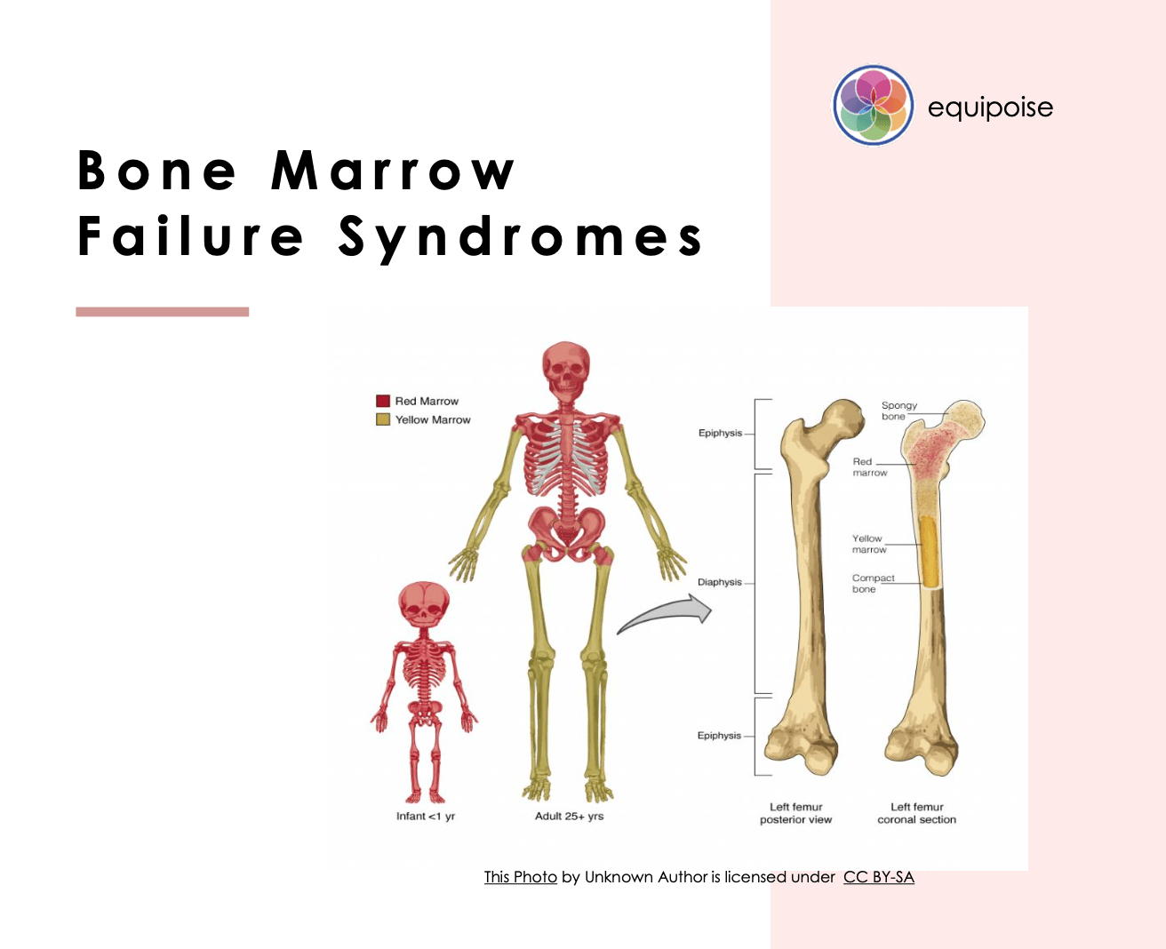 disease-information-bone-marrow-failure-syndromes