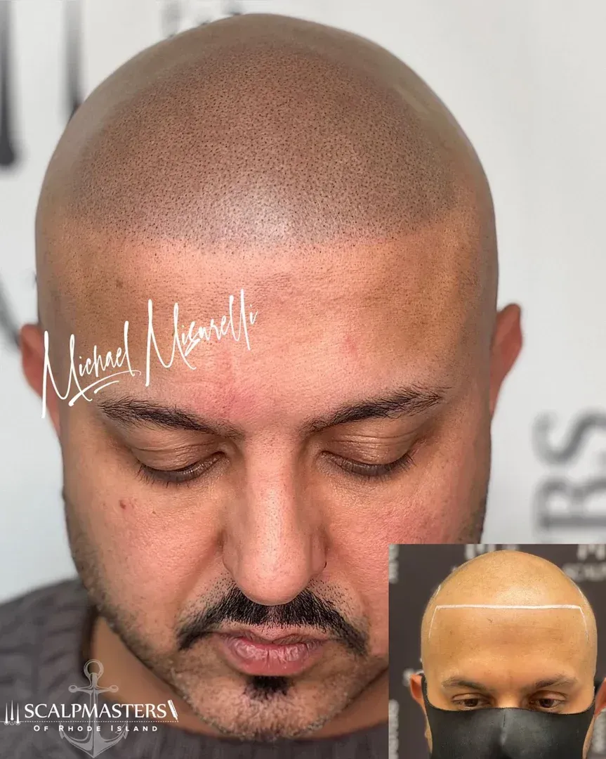 cranston smp for men