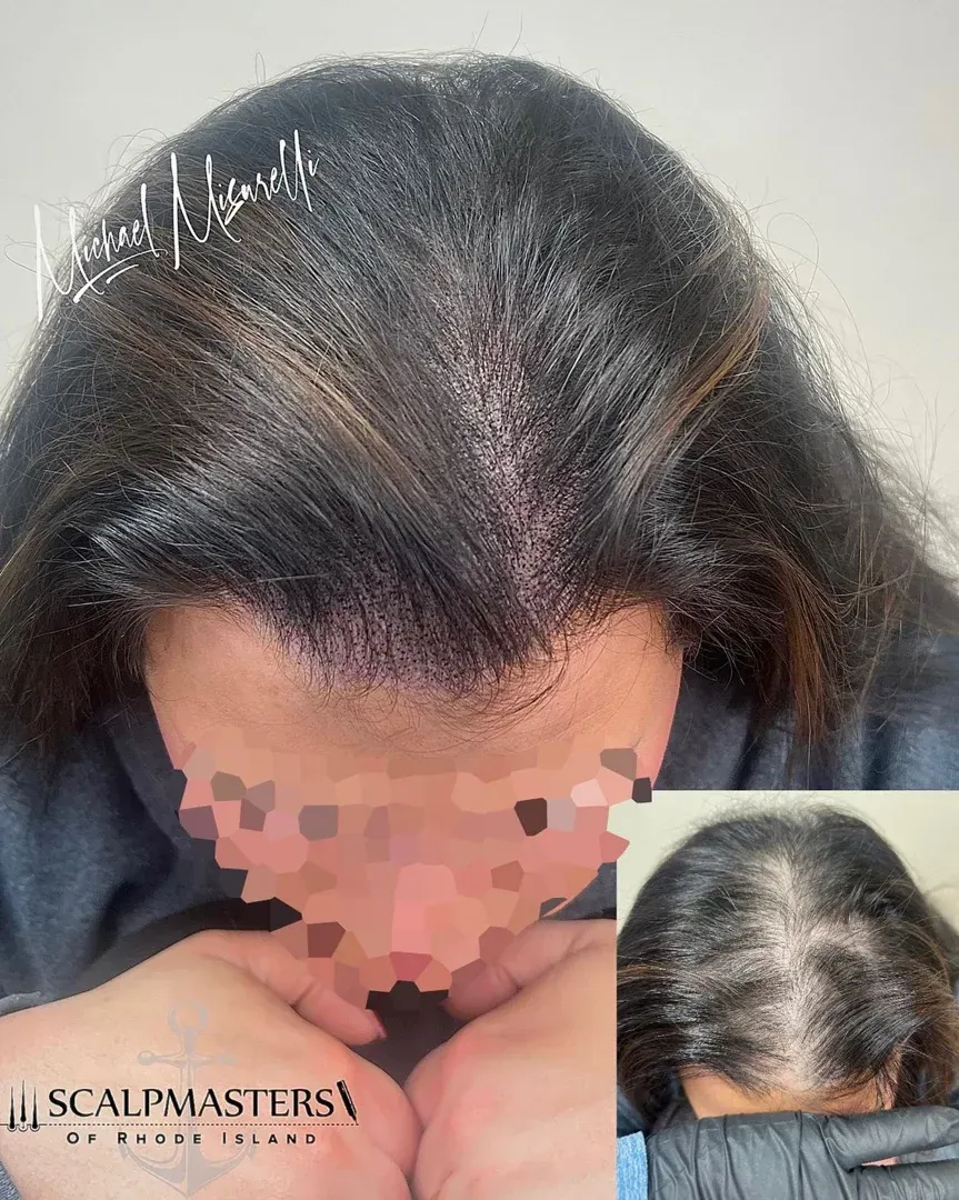connecticut hair restoration