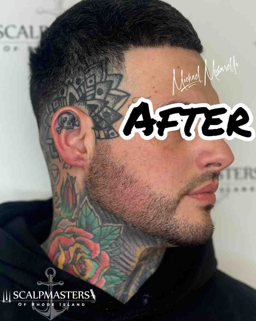 Close-up of a man's side profile showing the temple-to-jawline tattoo placement area - sideburn tatt