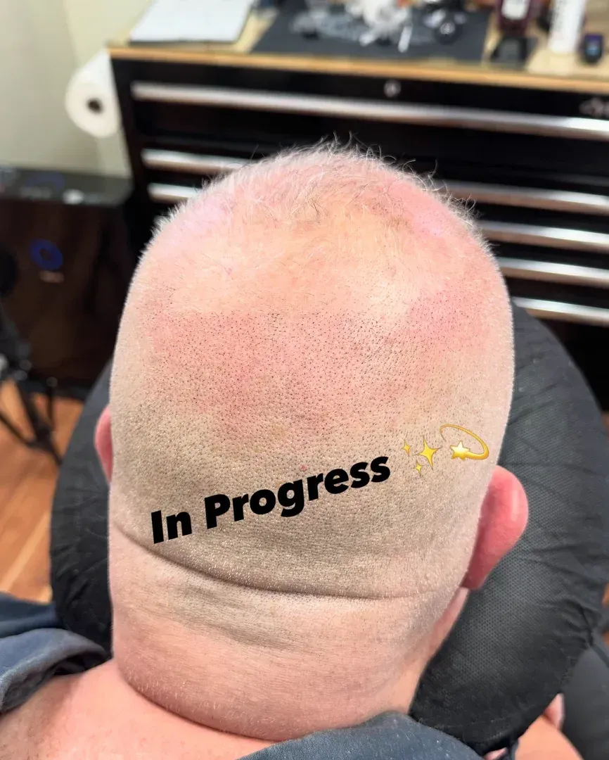 A client receiving a density SMP treatment in a clinical setting in Cranston