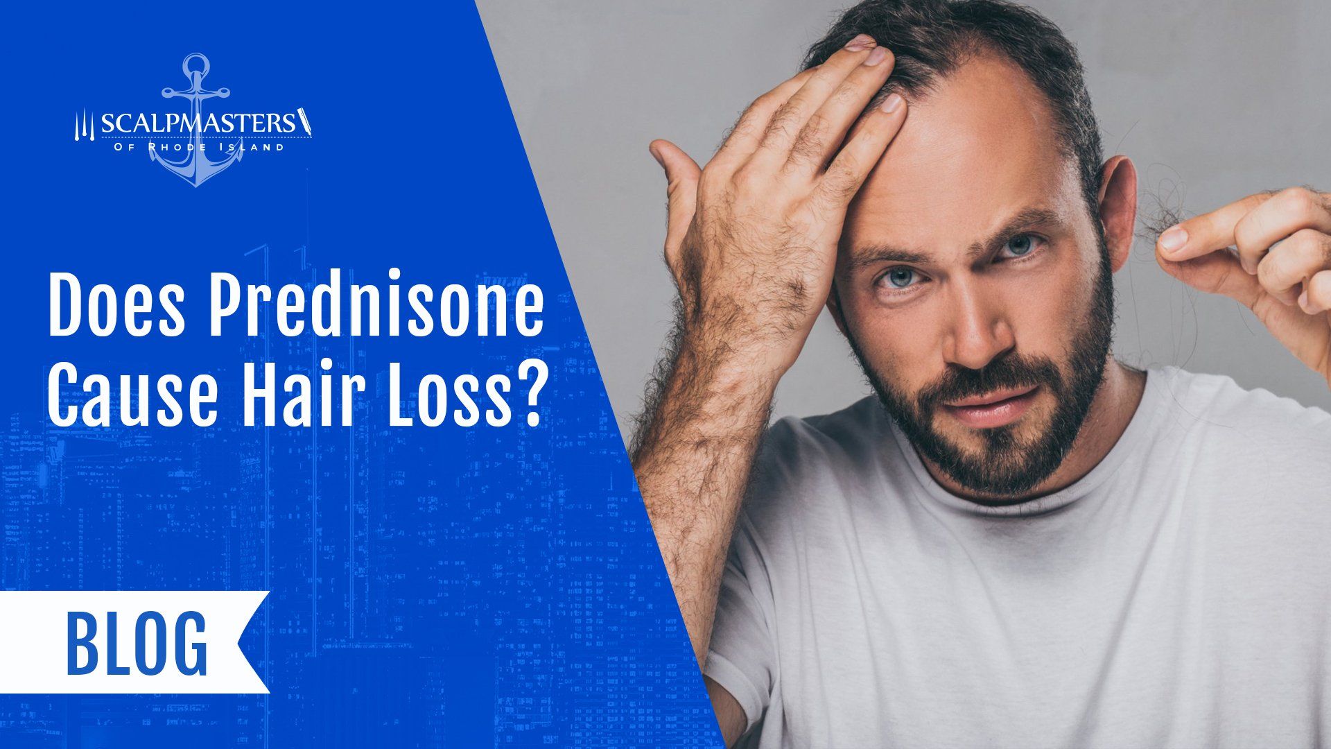 Does Prednisone Cause Hair Loss?