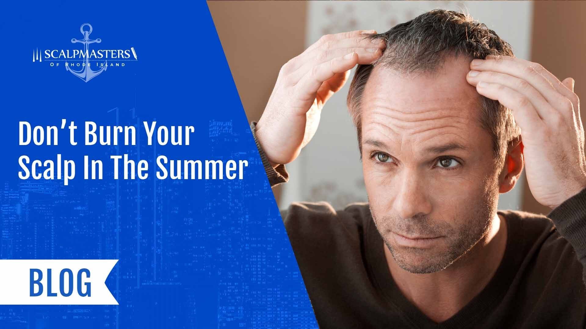 Protect Your Scalp From The Sun This Summer With These Tips 2065