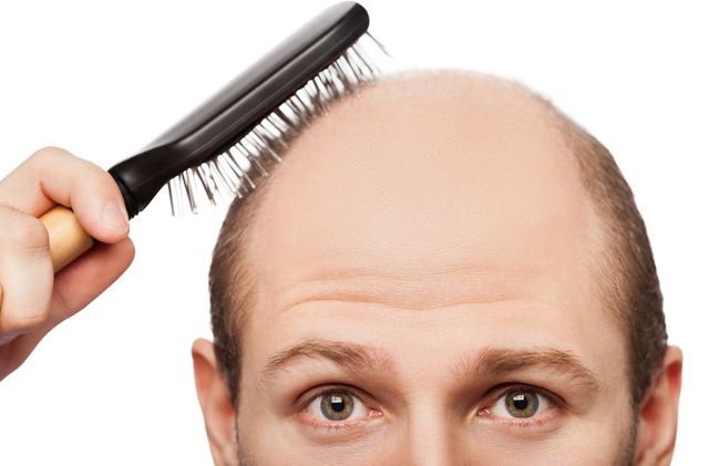 does tobacco cause hair loss Does Nicotine Cause Hair Loss? Understanding the Link