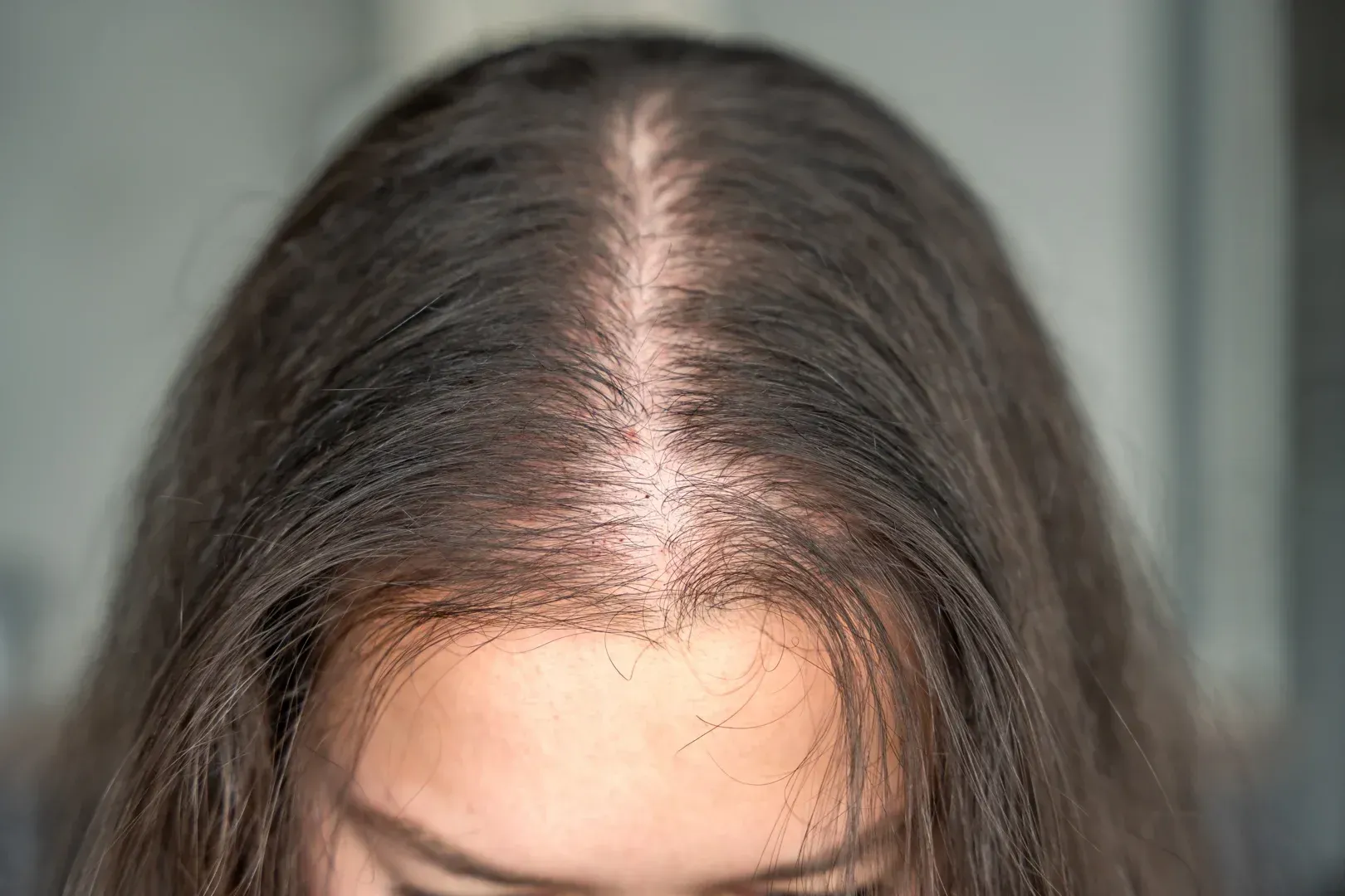 scalp tattoo women