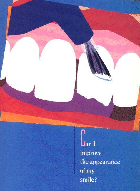 root canals Columbia, SC