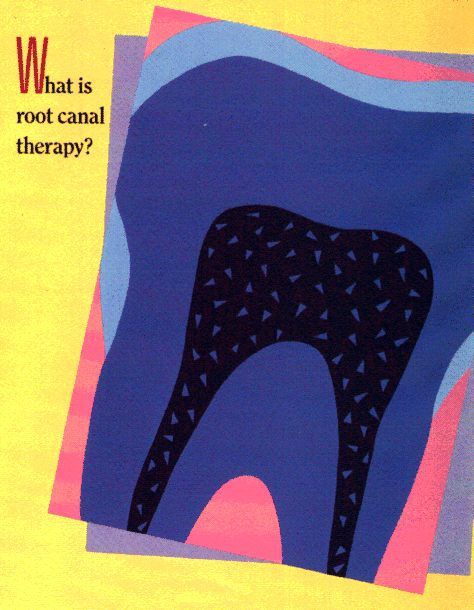 dental crowns Columbia, SC