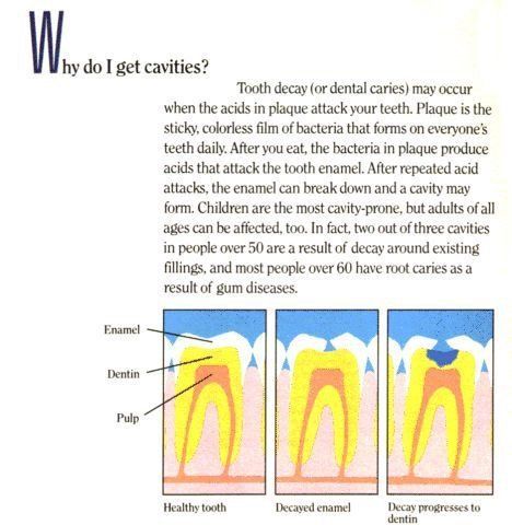 root canals Columbia, SC