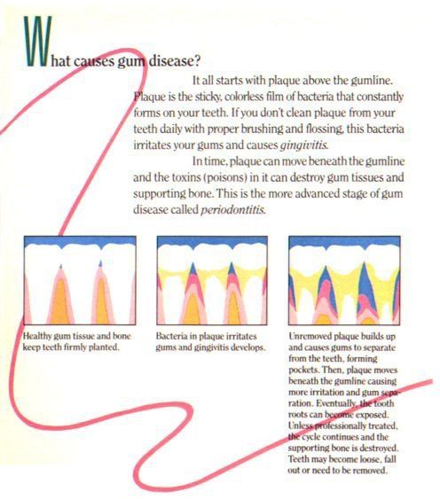 dental crowns Columbia, SC
