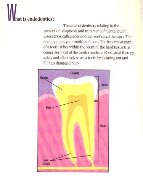 root canals Columbia, SC