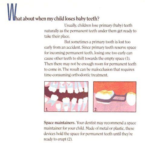 dental implants Columbia, SC