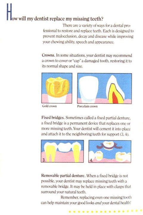 root canals Columbia, SC