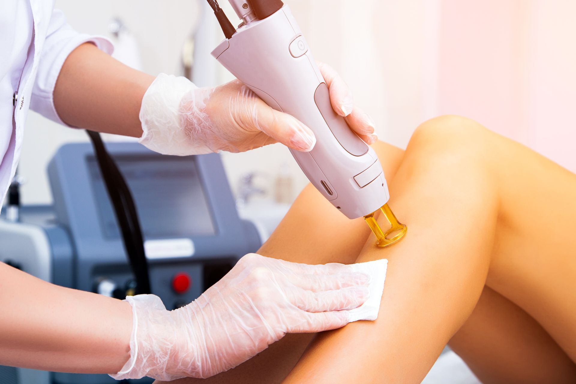Laser hair removal treatment on a leg, with a healthcare worker using a device in a medical setting.