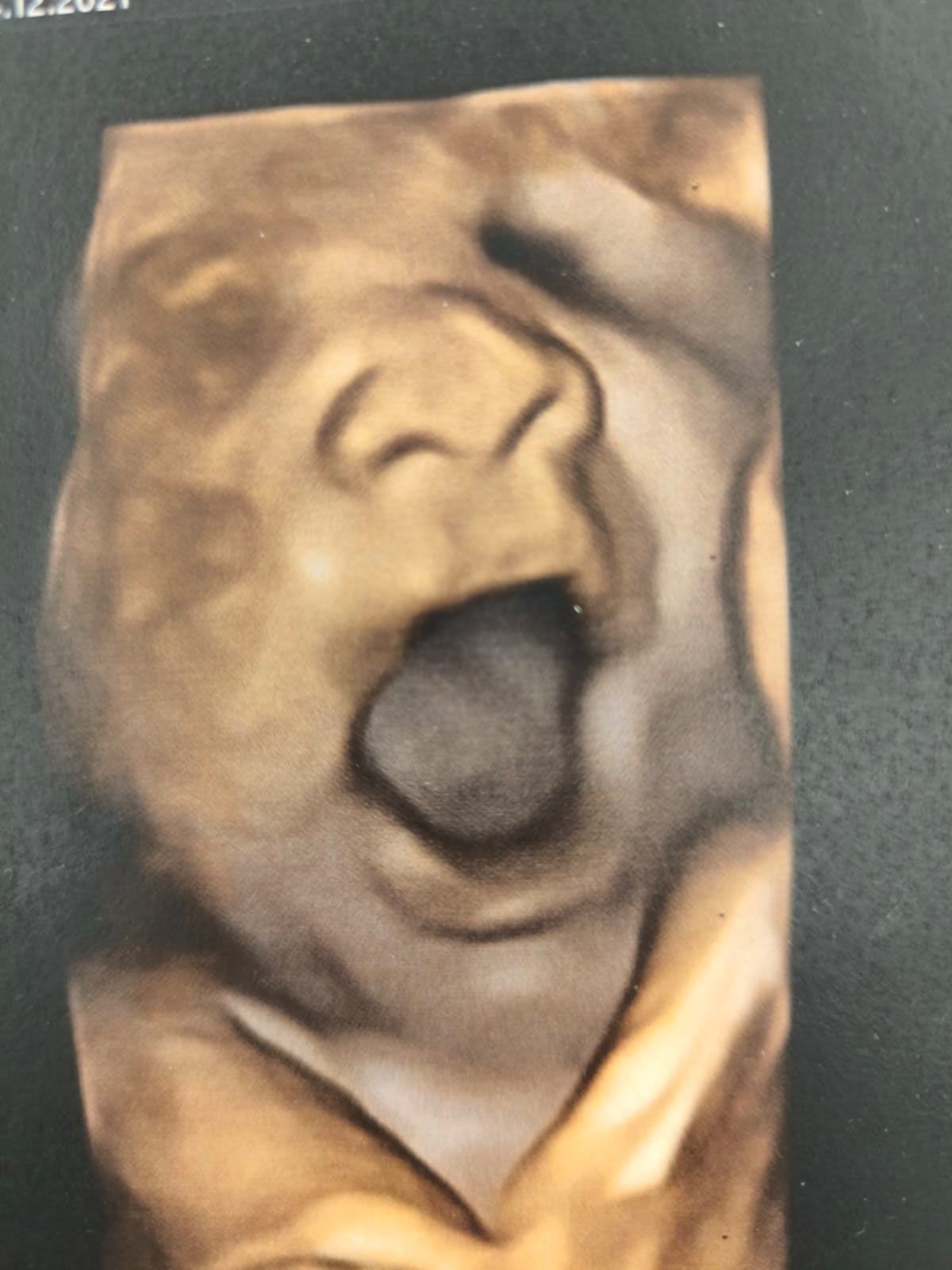 Un primo piano del viso di un bambino con la bocca aperta