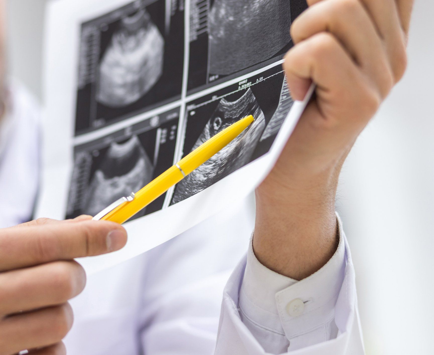 Una donna incinta viene visitata da un medico