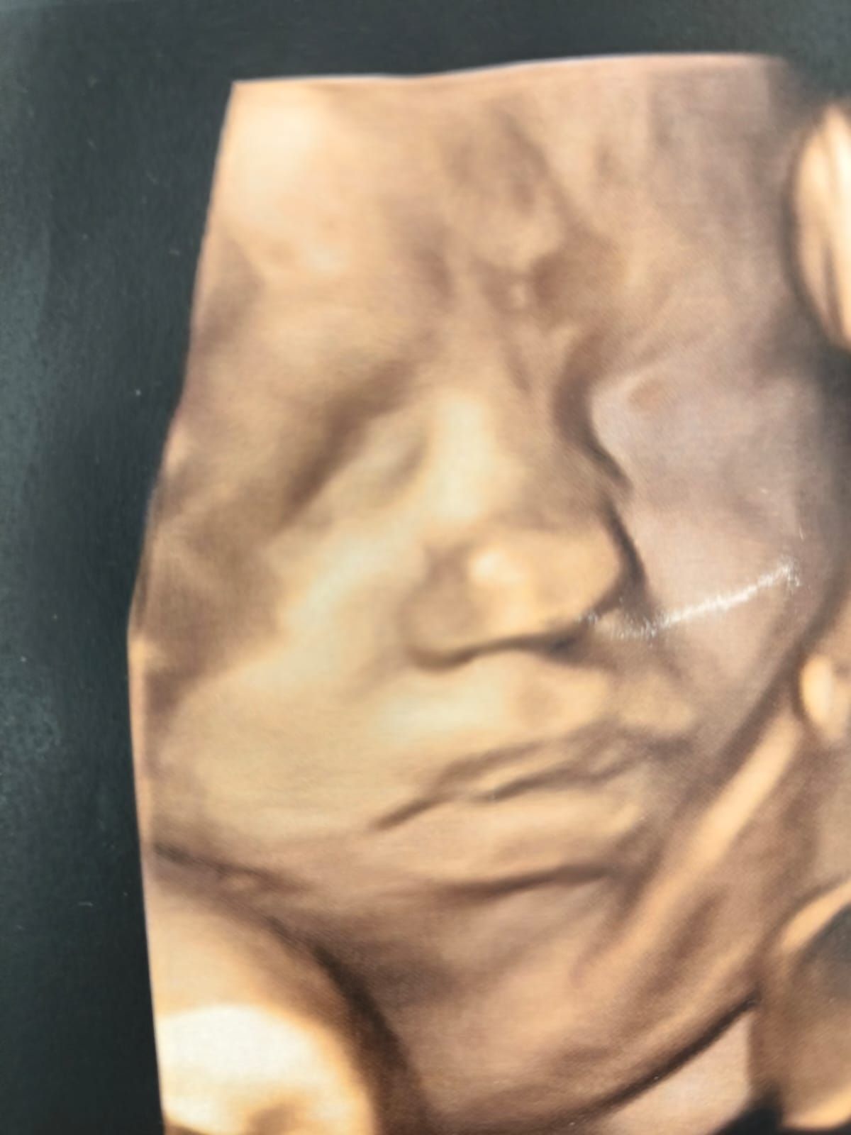 Un primo piano del viso di un bambino su uno sfondo nero