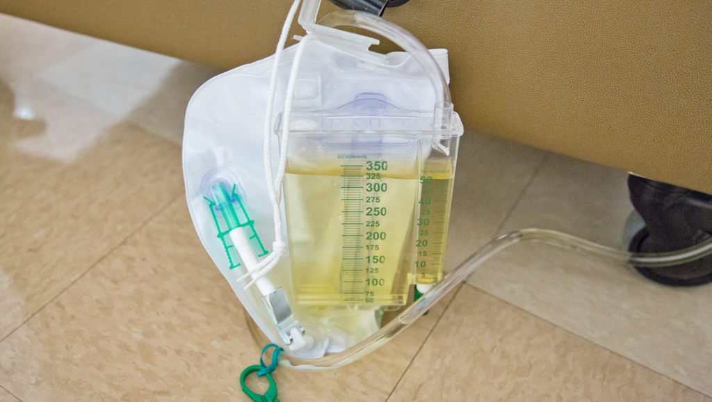 A bag of urine is sitting on the floor next to a urinal.