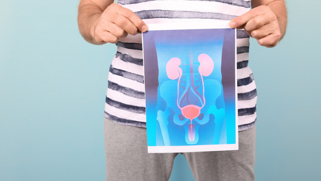 A man is holding a picture of a kidney and bladder.