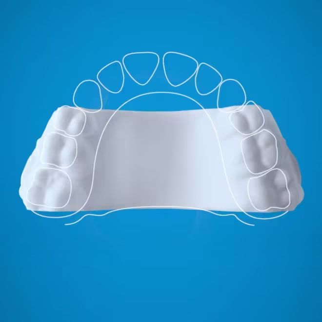 White dental impression model with teeth outline on a blue background.