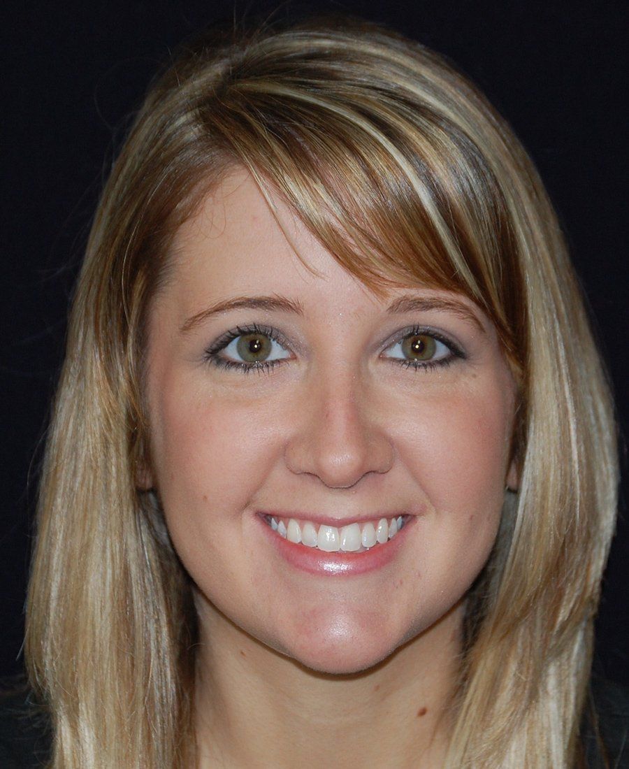 Nicole Knighton — Lyman, SC — Palmetto Smiles Prosthetic Dentistry