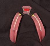 Partial Dentures — Lyman, SC — Palmetto Smiles Prosthetic Dentistry