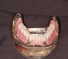 New Dentures — Lyman, SC — Palmetto Smiles Prosthetic Dentistry
