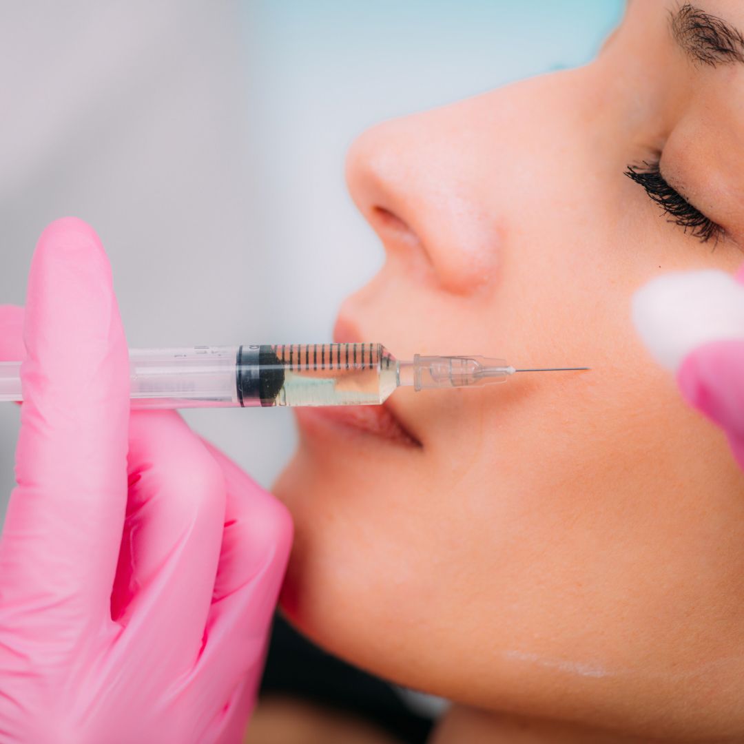 Dermal Fillers