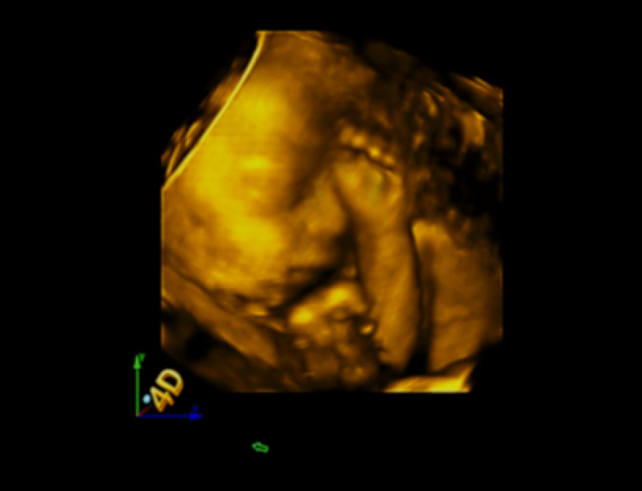 ECobs Imágenes y Consultas Médicas S.A.S - Ecografía 3D