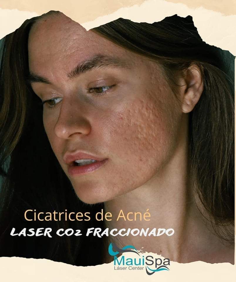 MAUI SPA LASER CENTER