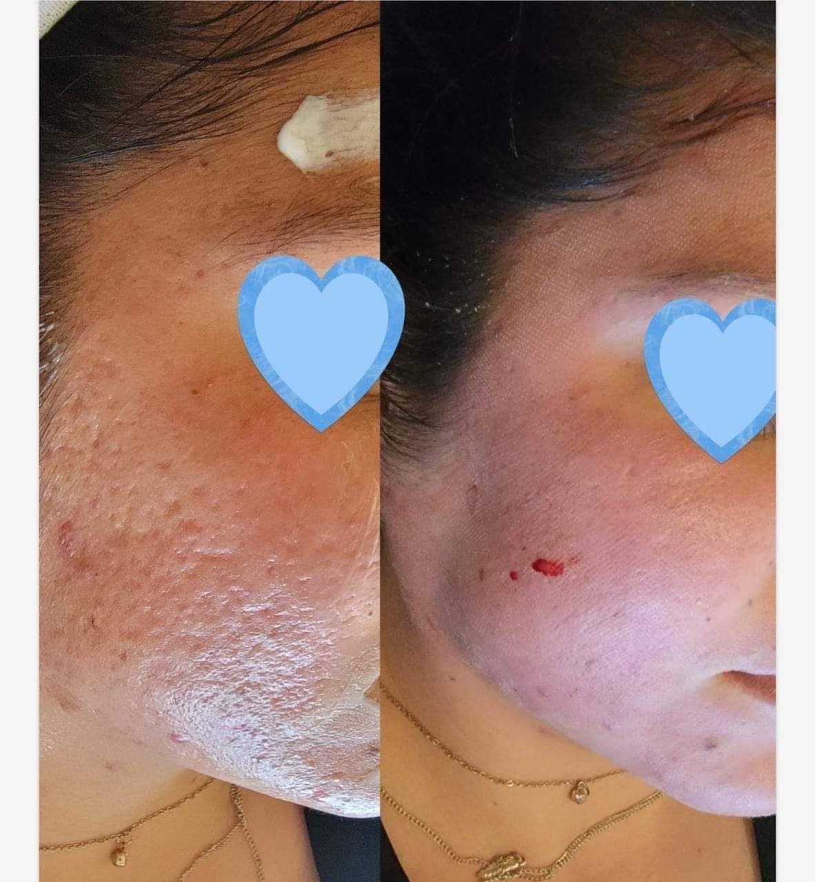 MAUI SPA LASER CENTER