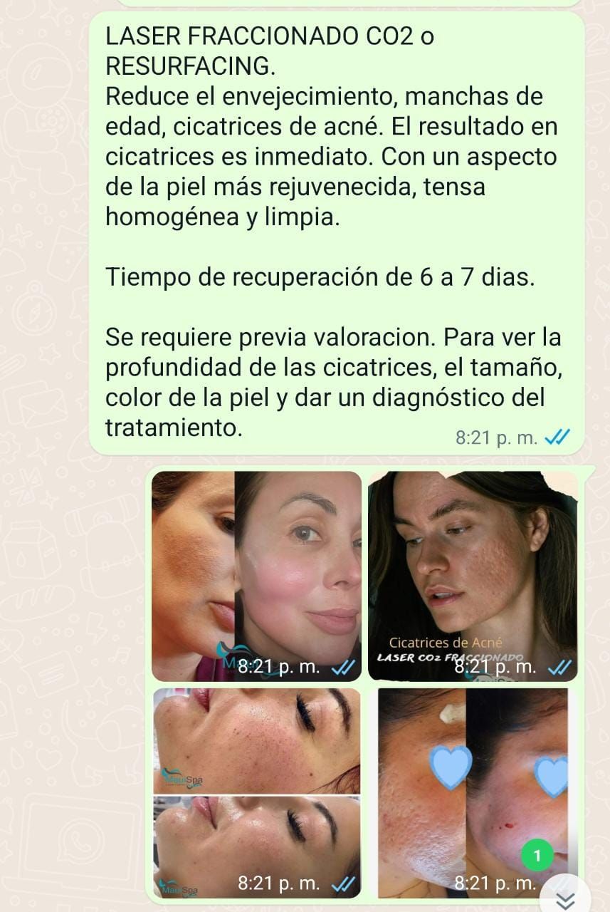 MAUI SPA LASER CENTER