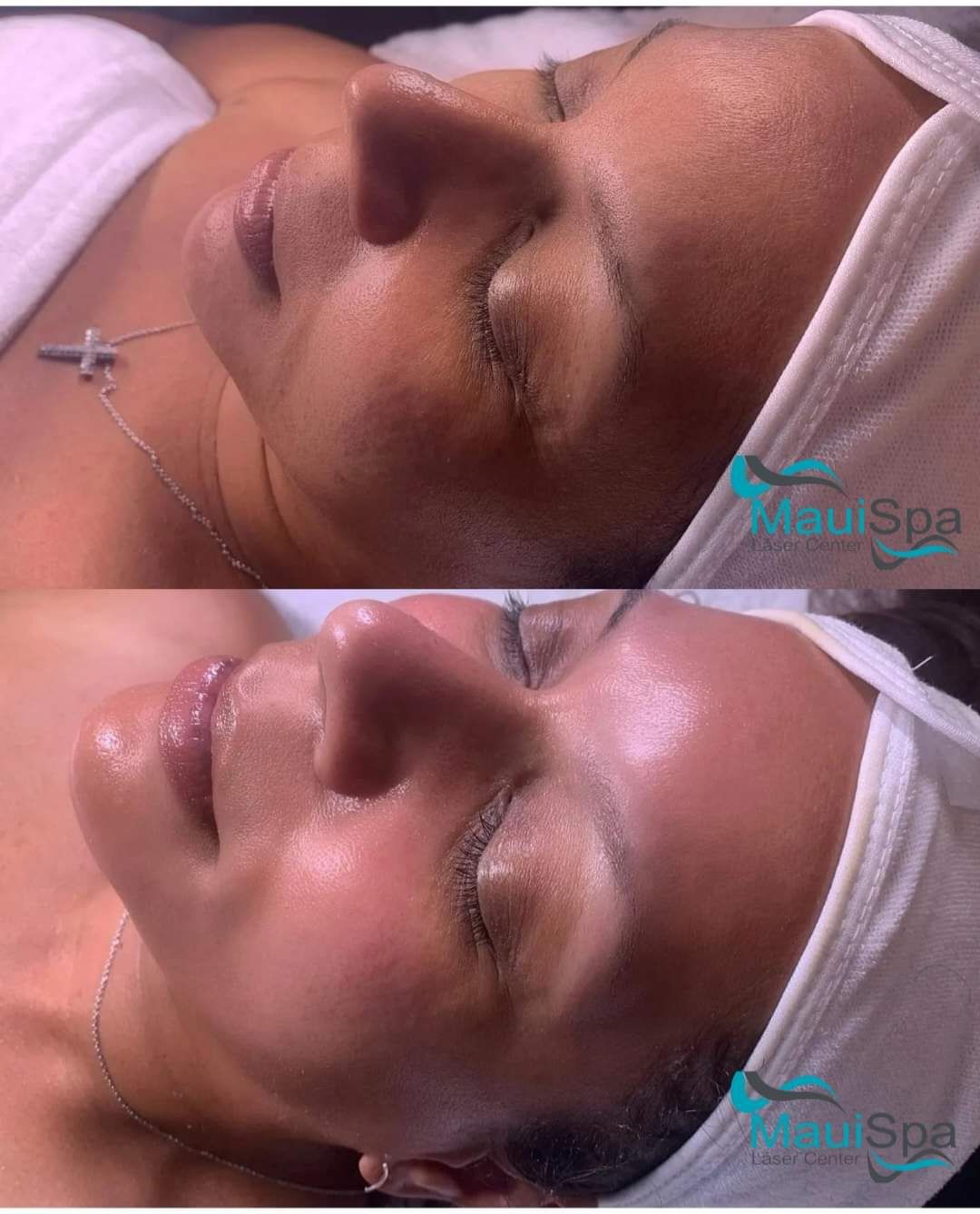 MAUI SPA LASER CENTER