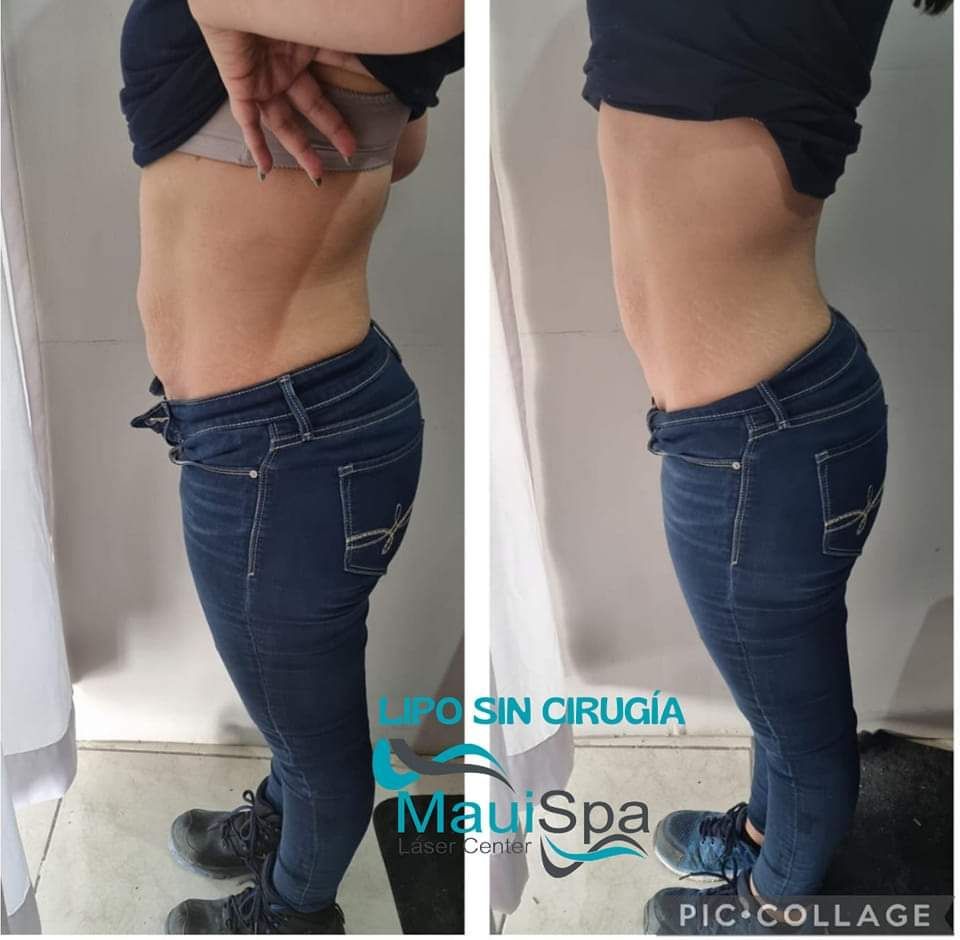 MAUI SPA LASER CENTER